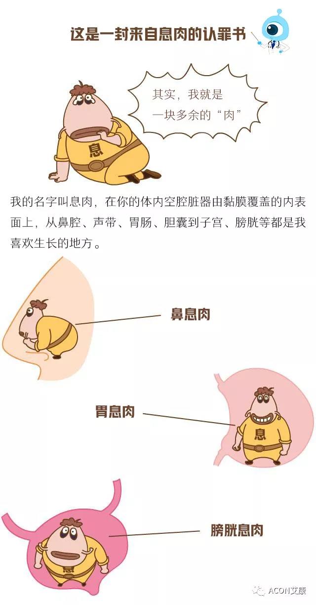 “艾”漫畫(huà) | 這是一封來(lái)自息肉的《認罪書(shū)》