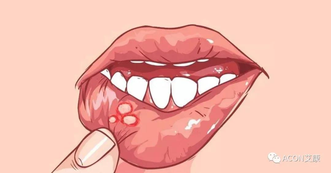 哪些小病容易讓人忽視，最后造成越拖越嚴重呢？