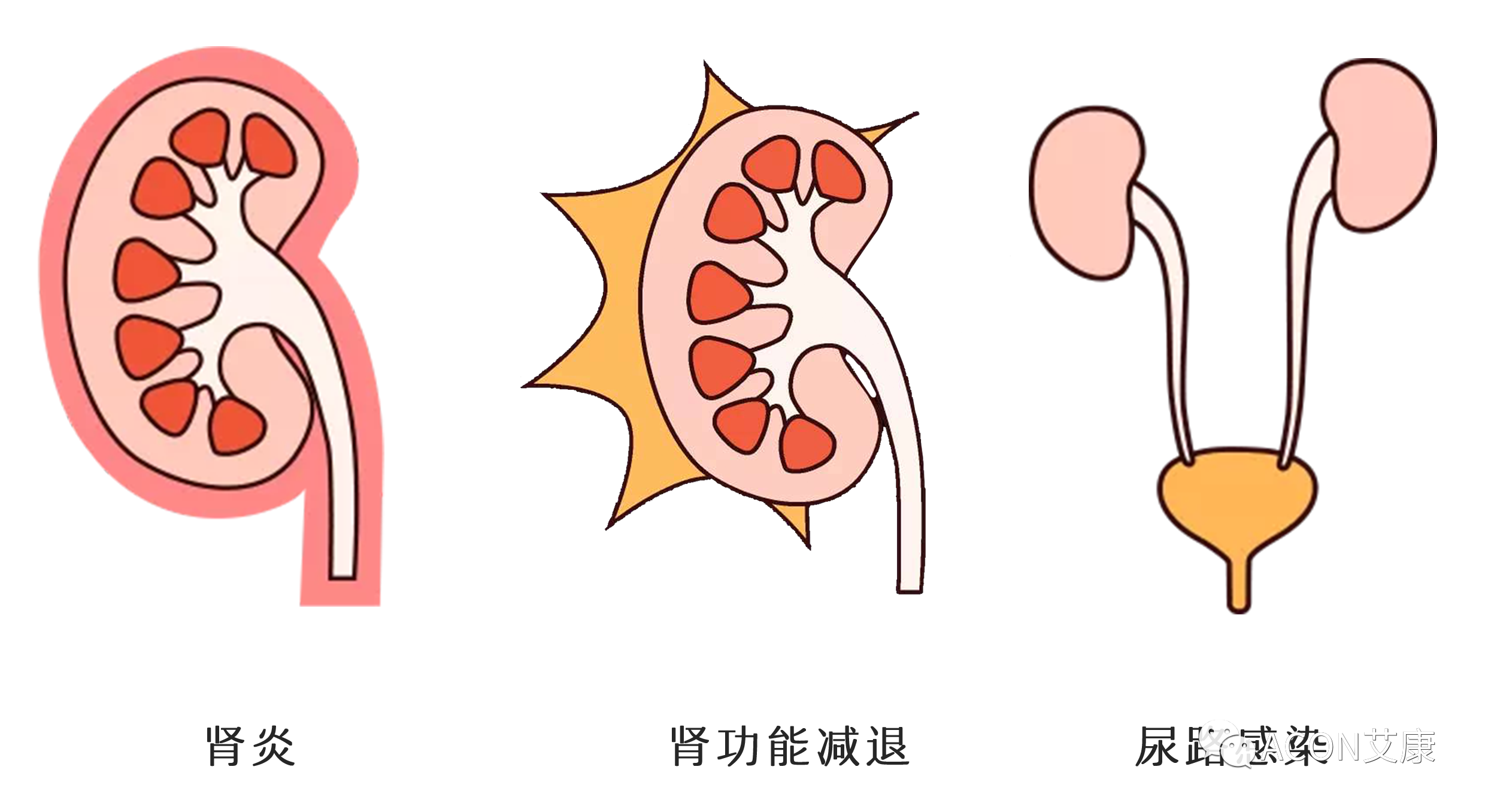 排尿黃、異味大，可能是身體在報警！
