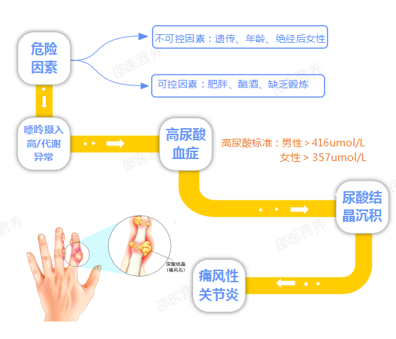 痛風(fēng)為什么偏愛(ài)男性？你最關(guān)心的問(wèn)題都在這里