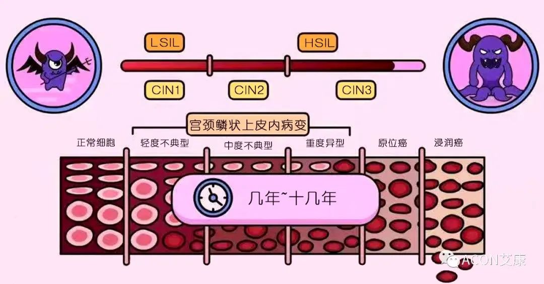全球首次承諾消除一種癌癥，預計到2050年將挽救500萬(wàn)人的生命