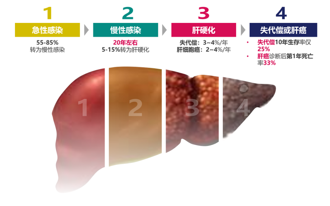 悄悄變成肝硬化、肝癌，很多人感染了卻不知道