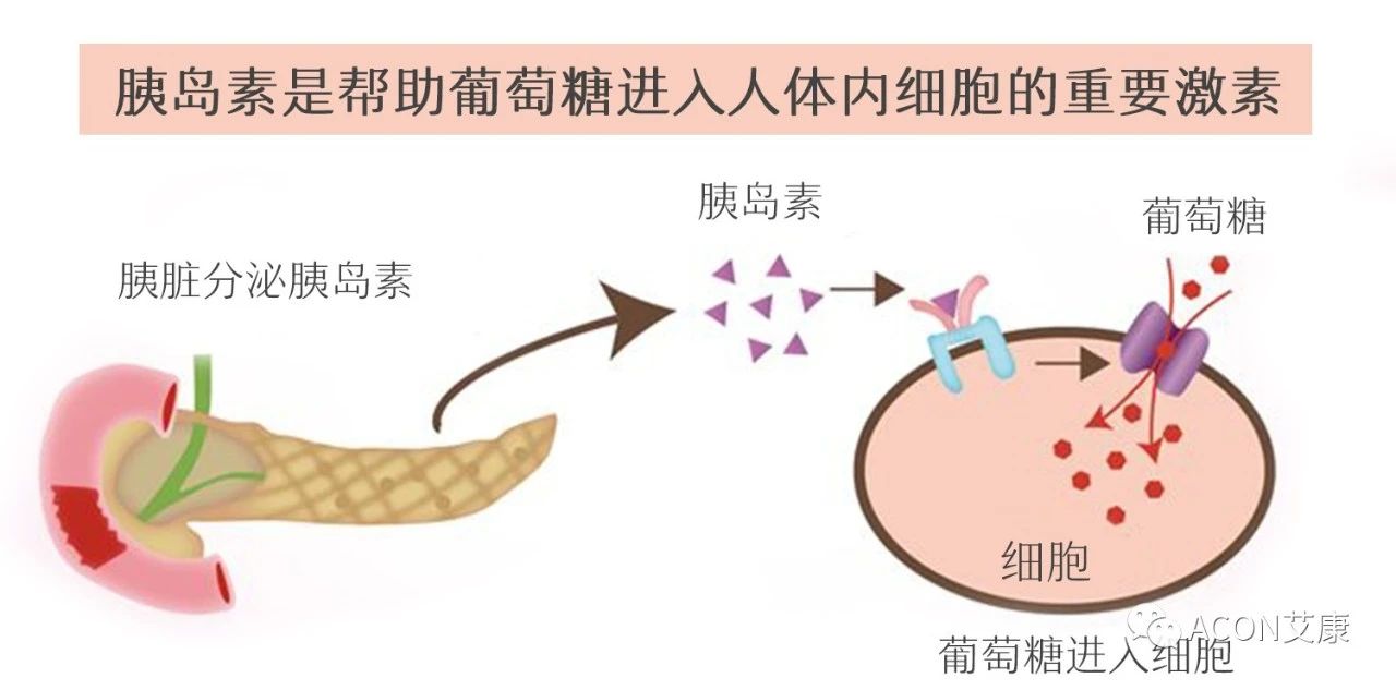 爆上熱搜，因爆發(fā)型糖尿病進(jìn)入ICU，有哪些教訓值得我們汲取