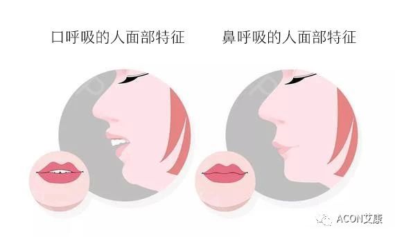 過(guò)敏性鼻炎會(huì )讓孩子變傻？！家長(cháng)該如何應對